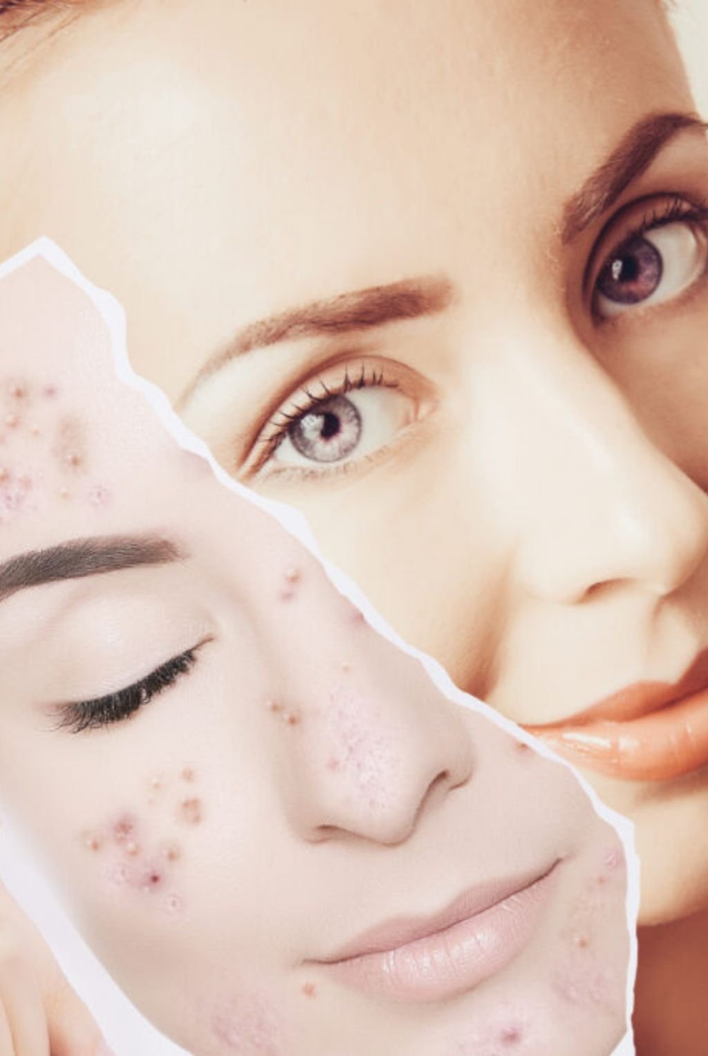 Renovación de la Piel - frescura